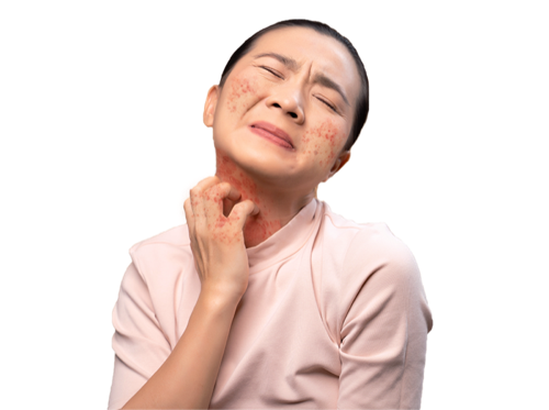 Skin_DEC21_edited.png