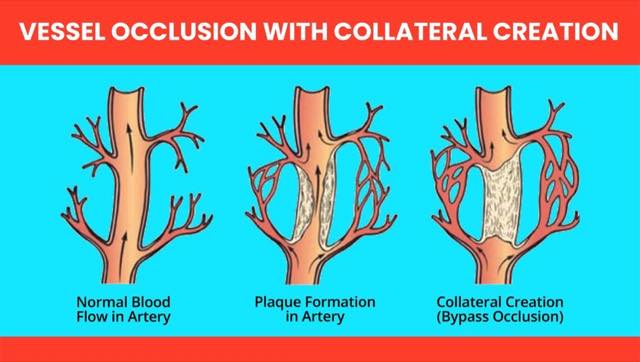 Collateral Ceation-01.jpg