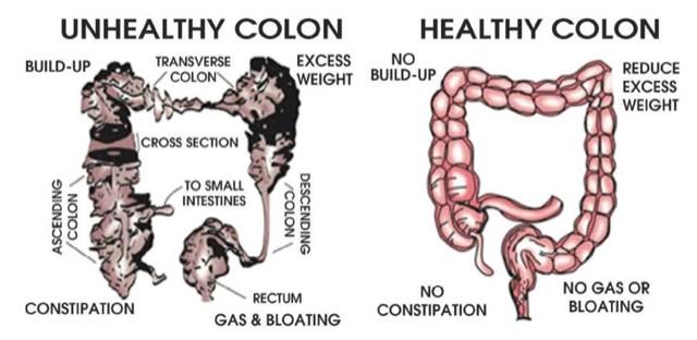 A Body Can't Fully Regenerate Itself When It Is Full Of Toxins