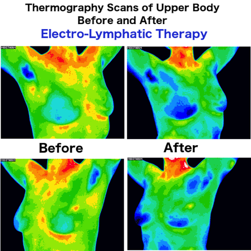 Thermography-Scans-Dual.png